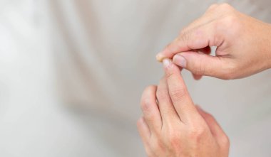 Kadın eli kuru, tırnak derisi çatlamış, derisi yırtılmış ve pul pul dökülmüş. Tamir için nemlendirici ile tedavi edilmeli..