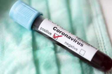 Tıbbi yüz koruma maskesinin üzerine yerleştirilmiş yeni Coronavirus enfeksiyonu için kan örneği içeren test tüpünün üst görüntüsü pozitif.