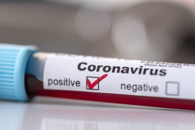 Kovid-19 enfeksiyonu için kan örneği olan bir test tüpünü kapat; yeni Coronavirus enfeksiyon testi konsepti