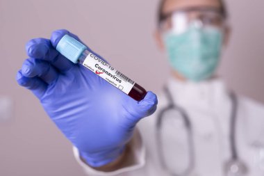 Epidemiyoloji uzmanı elinde yeni Coronavirus testi için kan örneği olan bir tüp tutuyor.