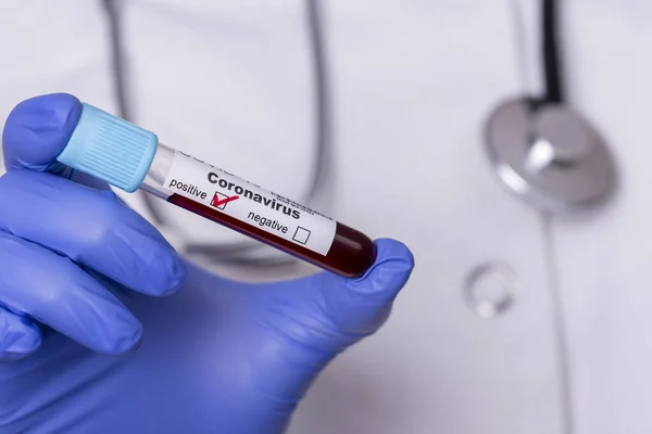 新型コロナウイルス検査のための血液サンプルを有する検査管を保持する疫学者 血液サンプルをテストするコビド19を保持する医師 — ストック写真