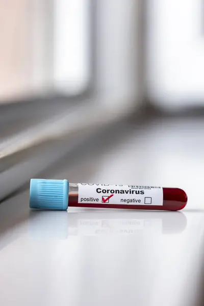 Blood Sample Test Tube Coronavirus Testing Positive Covid Infection — Stock Photo, Image