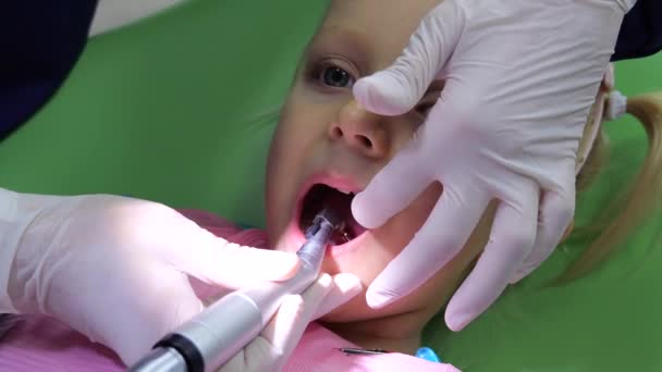 Enfant Fille Bouche Ouverte Pendant Procédure Polissage Des Dents Gros — Video