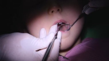 Pediatrik dişçi diş bakımı için diş aynası ve diş taraması kullanır. Dişçi randevusunda ağzı açık ve dişlerini aydınlatan yakın plan bir kız. Çocukların diş tedavisi kavramı 