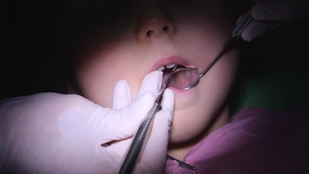 Dokter Gigi Pediatrik Mencari Karies Gigi Menggunakan Cermin Gigi Dan — Stok Video