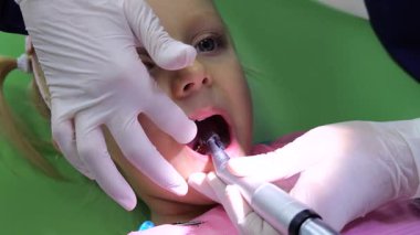 Modern diş kliniğinde genç hastaların dişlerini tedavi ederken özel polimerizasyon lambasını kullanarak diş dolgusunu tedavi eden profesyonel pediatrik diş hekimi.