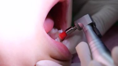 Profesyonel dişçi, genç hastaların dişlerini modern diş matkabı kullanarak dikkatlice cilalıyor, pediatrik diş prosedürü sırasında optimum ağız hijyeni ve diş sağlığı sağlıyor.