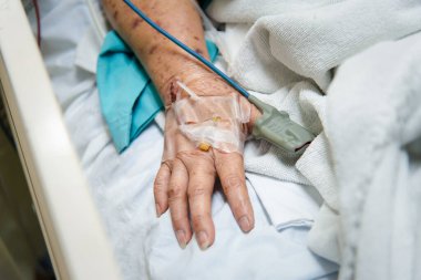 Hasta Asyalı yaşlı kadın 80 'li yaşlarda nezle, nabız ölçümü için nabız ölçer ve yoğun bakım ünitesindeki hasta yatağında yaşlı bir parmak üzerinde kan basıncı olan 19' u kapsıyor. Hastanedeki oda