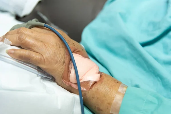 80歳以上のアジア系高齢女性80歳以上のインフルエンザは 集中治療室 Icu の患者のベッドで高齢者の指の心拍測定と血圧のためのパルスゲージで19をカバーしています 病院の部屋で — ストック写真