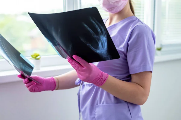 Doctor\'s hands holding at x-ray radiography images at clinic. Physician, surgeon reviewing scan of patient bones, screening test result. Medical checkup, healthcare, radiology concept.