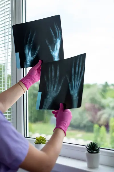 Doctor's hands holding at x-ray radiography images at clinic. Physician, surgeon reviewing scan of patient bones, screening test result. Medical checkup, healthcare, radiology concept.