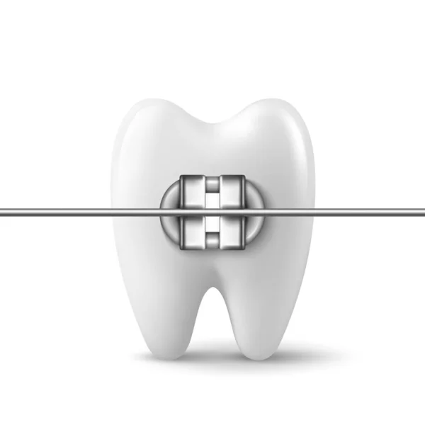 Vector Realistyczny Ząb Ikoną Aparatu Ortodontycznego Izolowany Białym Tle Szablon — Wektor stockowy