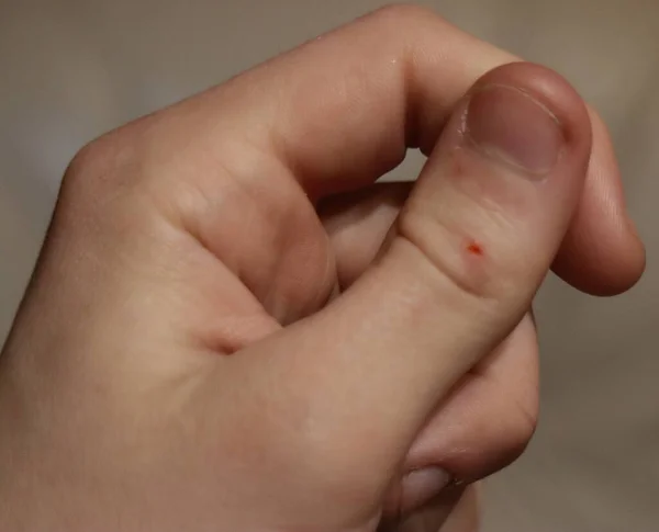 Finger cut, injury, human hand
