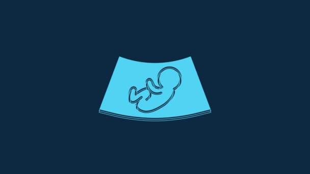 Niebieskie Usg Ikony Dziecka Izolowane Niebieskim Tle Płód Animacja Graficzna — Wideo stockowe