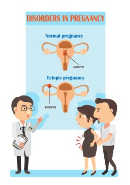 Doktor, dış gebelik ve normal hamilelikle konuşuyor. Vektör İllüstrasyonu
