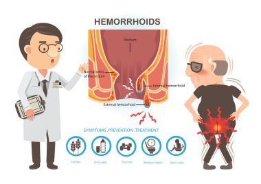 Hemoroit ve doktor ağrıları olan bir adam hastalarla konuşmak için. Anal anatominin diyagramı. iç ve dış hemoroitler 