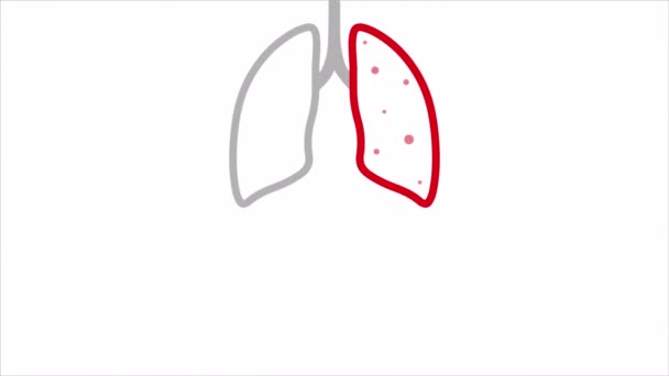 Día Mundial Tuberculosis Pulmón Enfermo Ilustración Video Arte — Vídeo de stock