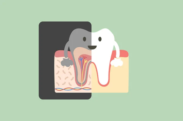 Zahnröntgen Zahn Hält Röntgenfilm Der Die Innere Struktur Der Zähne — Stockvektor