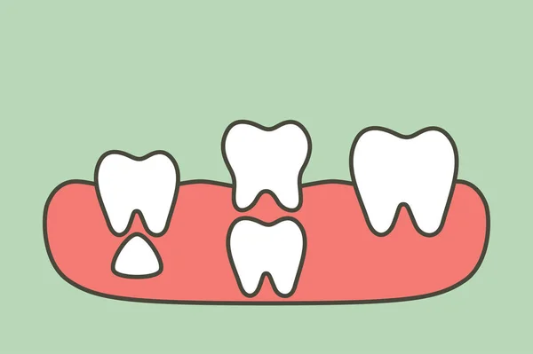 牙是从牙龈生长而来的恒牙 位于主牙下方 第一个牙齿 卡通人物平面造型可爱的设计人物 — 图库矢量图片