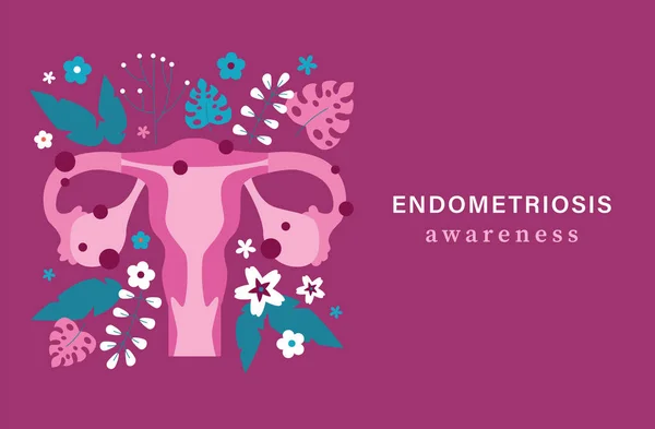 Endometriosis Awareness Background Uterus Flower Leaf Endometriosis Awareness Uterus — Archivo Imágenes Vectoriales