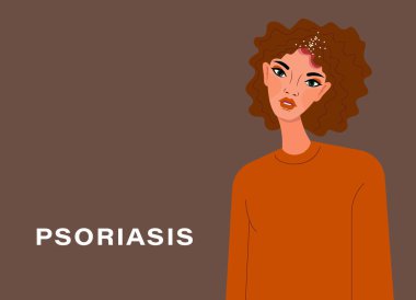 Sedef hastalığı farkındalığı. Deride sedef hastalığı etkilenmiş. Dermatolojik deri hastalığı. Sedef hastalığı, egzama, deri iltihabı, alerji. Kafasında deri lezyonları var.