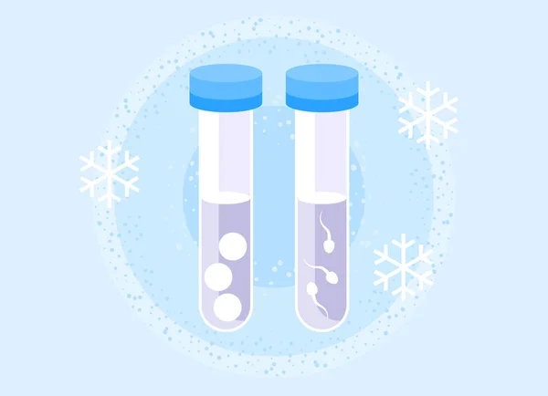 Stock vector IVF freezing. Cryopreserved sperm. Frozen sperm utilization. Cryopreservation of genetic material. Reproductive technology. Artificial insemination. Female cell donation. Egg freezing. Egg donation