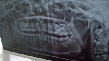 Dişçinin muayenehanesinde panoramik diş röntgeni..