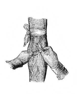 Orgelbrand 'dan Ansiklopedi Medycyny' nin eski kitabında kolu kanıyor. 17, 1890, Warszawa