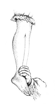 Eski kitap Ansiklopedya Medycyny 'de eğrilik için masaj, Orgelbrand, vol. 17, 1890, Warszawa