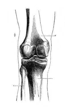 Diz eklemi, eski kitap Encyklopedya Medycyny, Orgelbrand, 1890, Warszawa