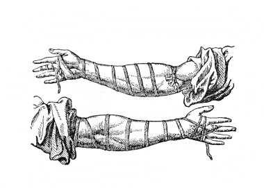 Fillion, 1883, Paris 'ten Atlas de la Bible' in eski kitabında kolun etrafına sarılmış Phylacpiller.