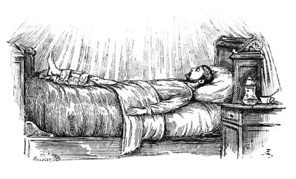 Orgelbrand 'ın Encyklopedya Medycyny' sindeki sakatlık sırasında bacağın geçici pozisyonu, vol. 17, 1890, Warszawa