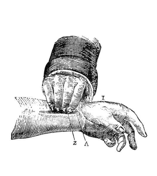 Orgelbrand, vol 'dan Ansiklopedi Medycyny' nin eski kitabındaki nabzı hissediyorum. 17, 1890, Warszawa