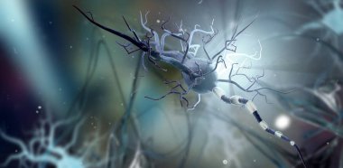 Sinir hücreleri, nörolojik hastalıklar, tümörler, beyin ameliyatı. 3d Görüntü 