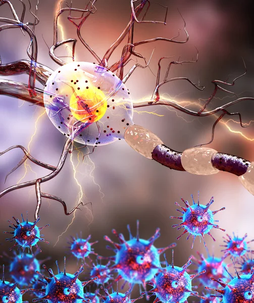 Zenuwcellen Neuron Neurologische Ziekte Tumoren Hersenchirurgie Illustratie Stockafbeelding