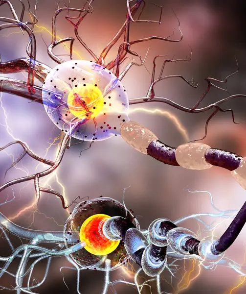 Idegsejtek Neuron Neurológiai Betegség Daganatok Agyműtét Illusztráció — Stock Fotó