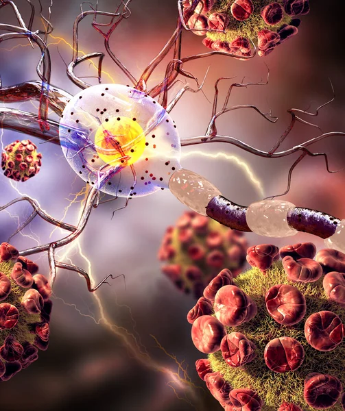 Cellule Nervose Neuroni Malattie Neurologiche Tumori Chirurgia Cerebrale Illustrazione Fotografia Stock