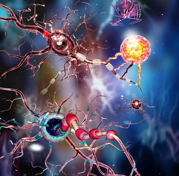 Cellules Nerveuses Neurones Maladies Neurologiques Tumeurs Chirurgie Cérébrale Illustration — Photo