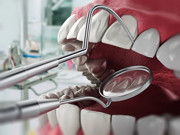 Ανθρώπινο Μοντέλο Δοντιών Και Επαγγελματικά Οδοντιατρικά Εργαλεία Στο Φόντο Οδοντιατρική — Φωτογραφία Αρχείου