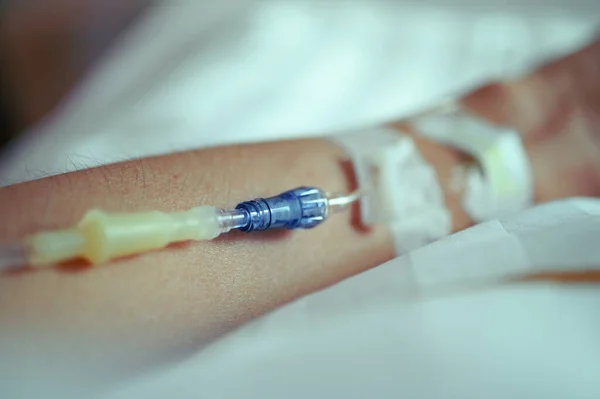 Intravenöse Flüssigkeit Zur Behandlung Von Patienten Krankenhaus — Stockfoto