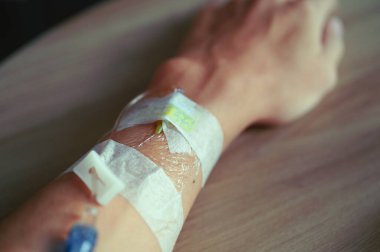 Hastanedeki hastayı tedavi etmek için damar içi sıvı.