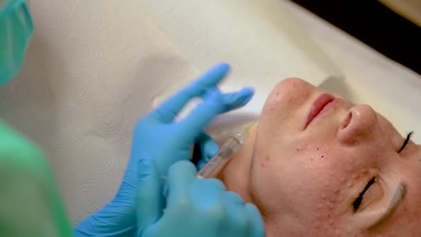 Kopierraum Nahaufnahme Kosmetologe Macht Injektionen Die Haut Des Schönen Mädchens — Stockvideo