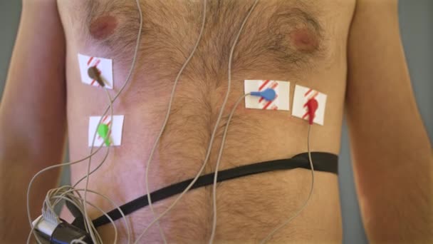 Ein Elektronischer Maschinenhalter Mit Vielen Drähten Und Medizinischen Elektroden Überwacht — Stockvideo