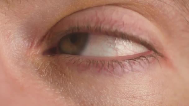 Nemocný Oční Bulva Pohybuje Vzhůru Nohama Zleva Doprava Zblízka Muž — Stock video