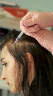 Saç enjeksiyonu. Güzellik uzmanı saç büyütmek için kafa derisine iğne yapıyor. Saç uzatmak ve güzellik salonunda güçlenmek için mezoterapi. Saç dökülmesine karşı prosedür. Dikey oryantasyon. Gençleştirme