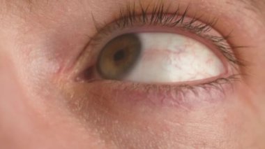 İnsan gözleri ve görüşü odaklanma, görme ve farkındalık. Kapalı portre yüz makrosu, optometri testi ve insan anatomisi algısı. Görme sorunu olan bir erkek, miyop, göz kapakları iltihaplanmış.