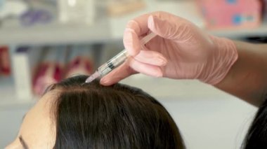 Şırınga ve iğne ile. Güzellik doktoru saç büyümesi için kafasına iğne yapıyor. Saç uzatmak ve güzellik salonunda güçlenmek için mezoterapi. Dikey oryantasyon. Yaşlanma karşıtı