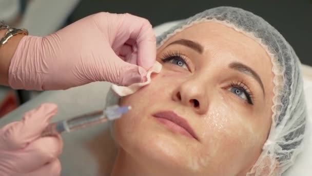 美容院实施抗衰老注射程序的女性患者 医生对妇女面部的特定部位小心地进行皮肤治疗 可注射的美容术和 — 图库视频影像