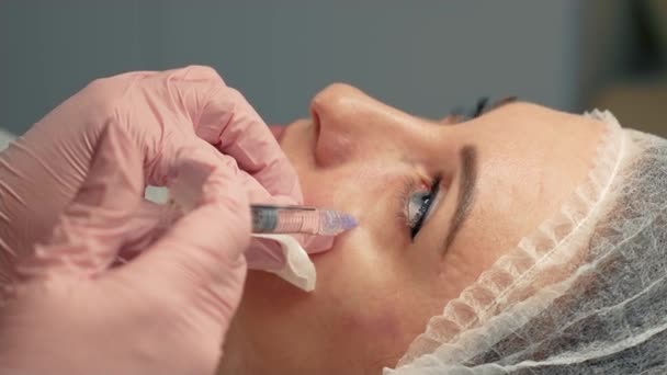 Orvos Által Alkalmazott Botulázs Injekciózás Alatt Álló Kozmetikus Óvatosan Beadni — Stock videók