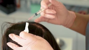 Şırınga ve iğne ile. Saç dökülmesine karşı prosedür, saç uzatmak ve güzellik salonunda güçlenmek için kelleşmeye karşı mezoterapi. Güzellik tedavisi konsepti, gençlik, rahatlık, yüz bakımı